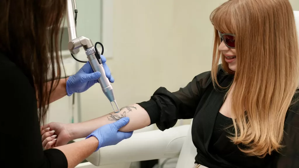 ND:YAG laser treatment for tattoo removal