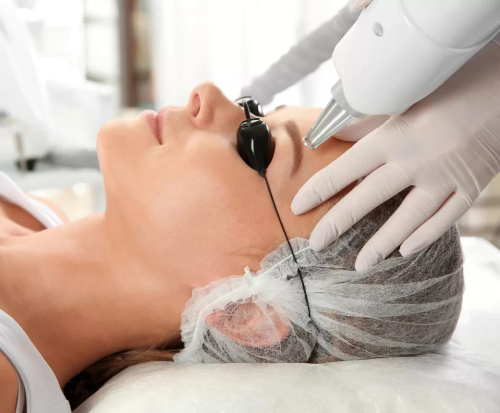 ND:YAG laser treatment for removing hair