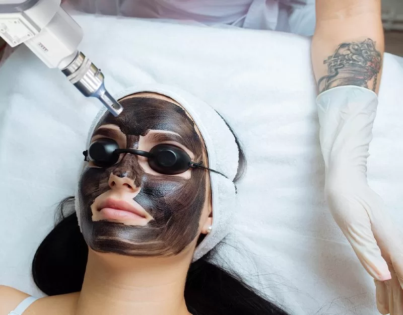 ND:YAG laser for skin rejuvenation