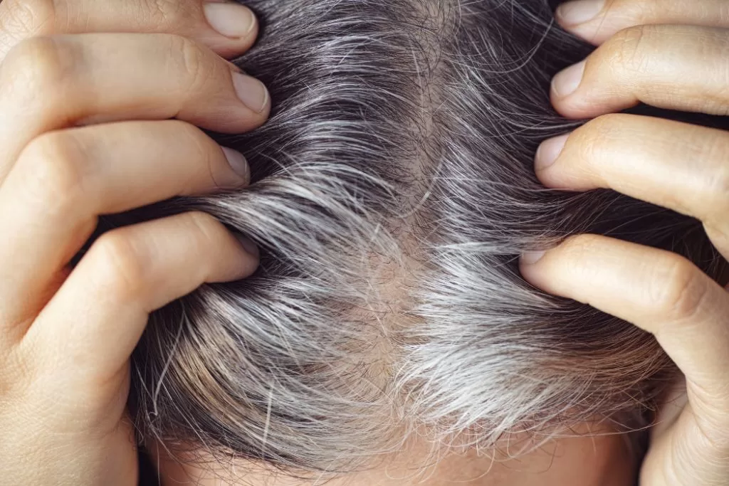 Gray or white hair on the head