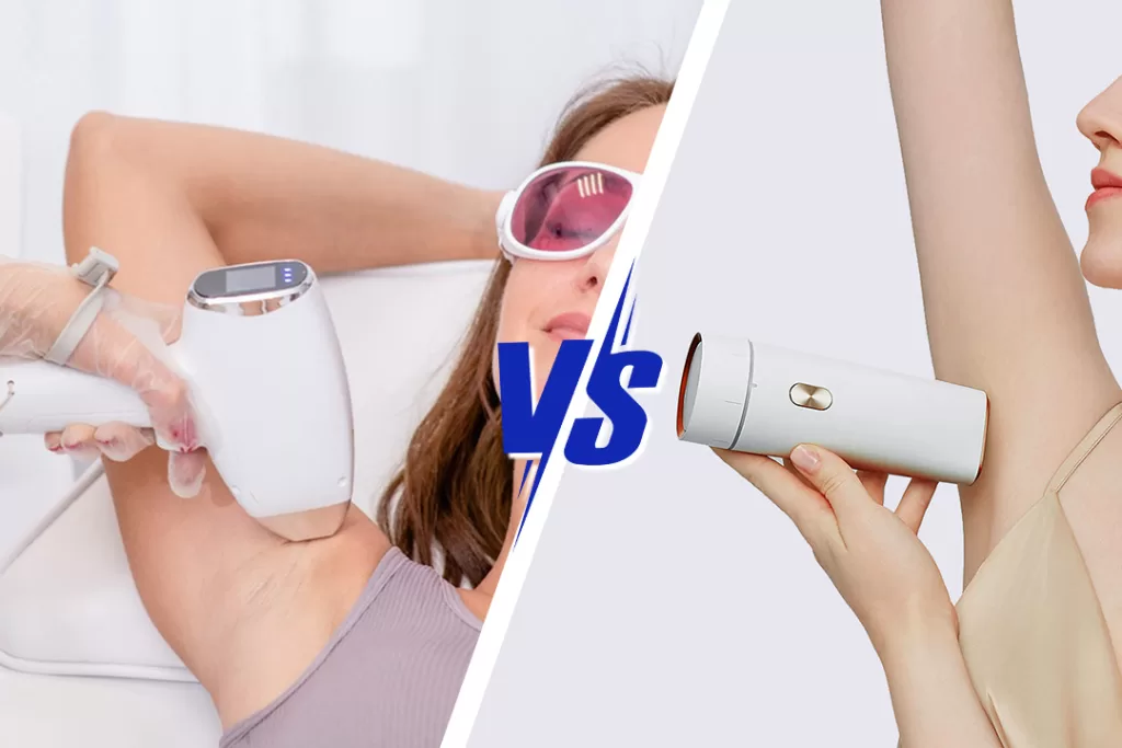 Home Hair Removal Devices vs. Professional Hair Removal Equipment for underarm hair removal treatment