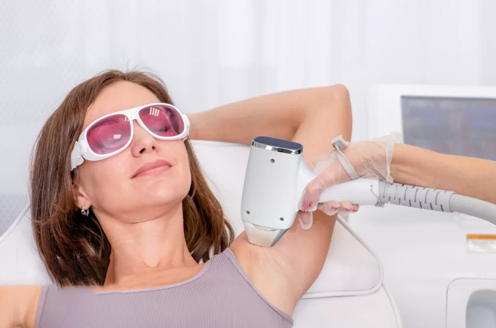 underarm laser hair removal treatment